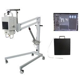 [E014115] Digital Mobile Radiography X-Ray System