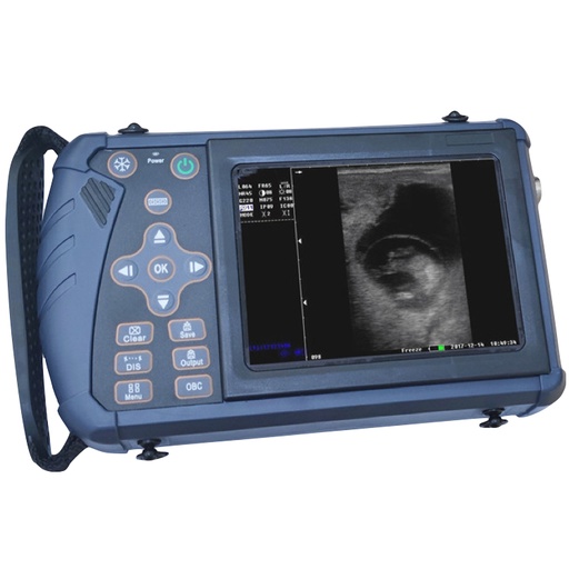 [E014163] VC-U1 (Handheld B/W Digital) + Rectal Probe