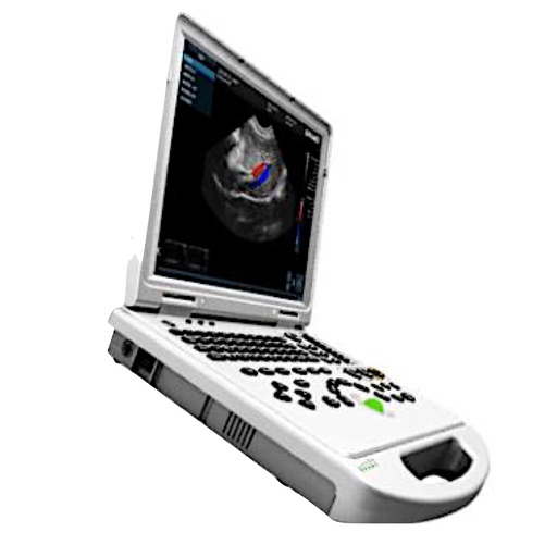 [E014613] VC-6 Pro Laptop Color Doppler w/ Convex + Linear + Phassed Array Probe